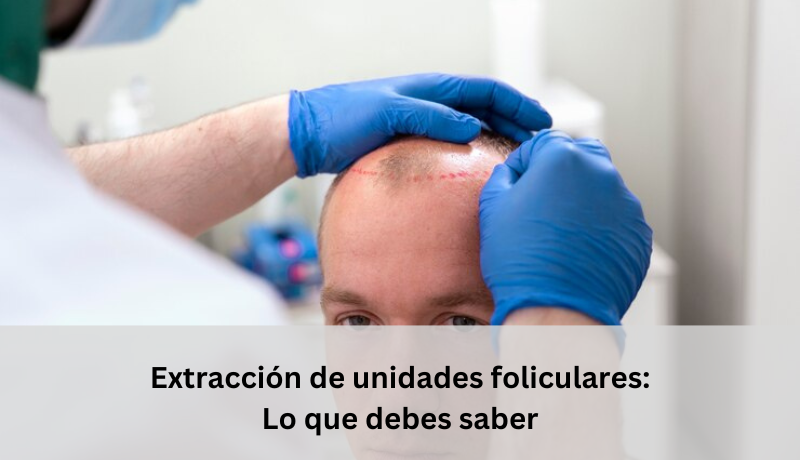 extracción de unidades foliculares